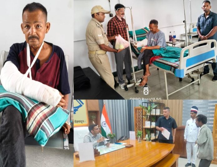 दून अस्पताल से लाइलाज रेफर हुए व्यथित राजू का, बर्न स्पेशलिस्ट हेल्पिंग हैंड्स यहां ऑपरेशन हुआ संपन्न